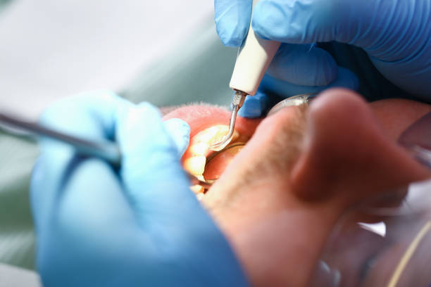 Best Teeth Whitening  in Woodsfield, OH