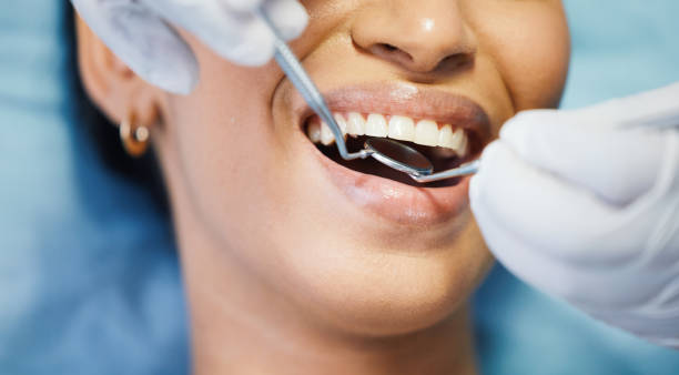 Best Chipped Tooth Repair Near Me  in Woodsfield, OH