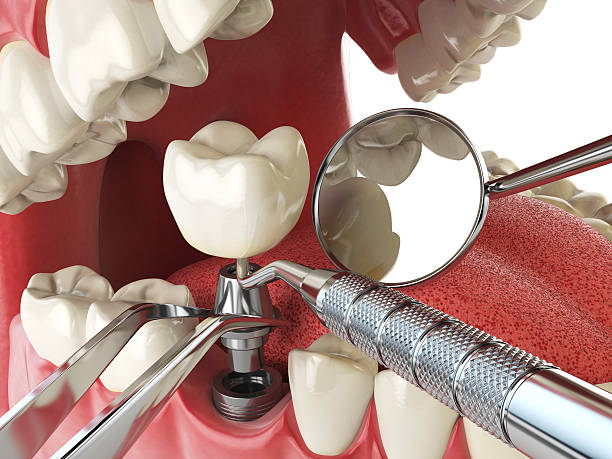 Best Emergency Dentist Near Me  in Woodsfield, OH