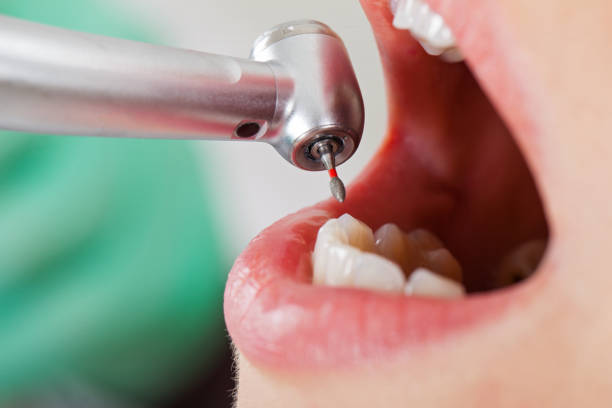 Best Broken Tooth Emergency  in Woodsfield, OH